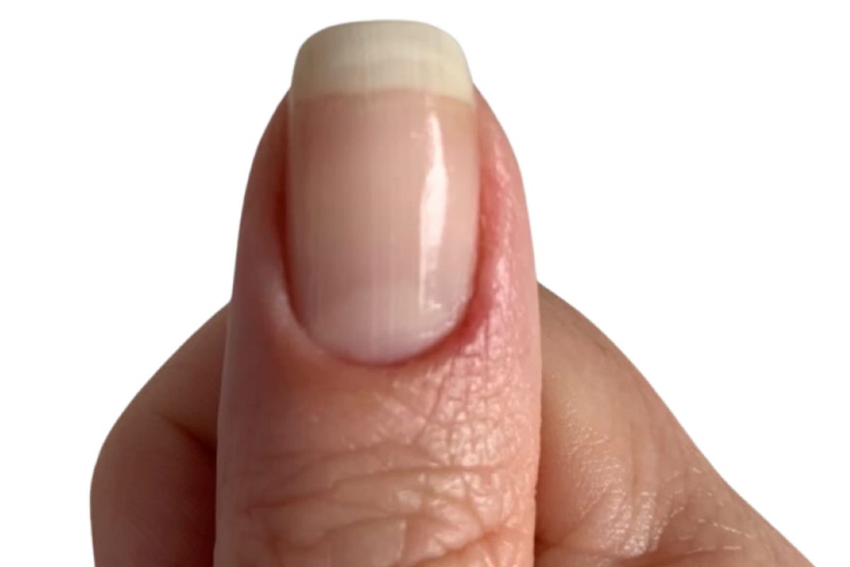 Why Do Some People Have Half Moons On Nails